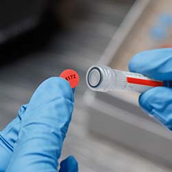 Una etiqueta roja aplicada en la parte superior de un tubo.