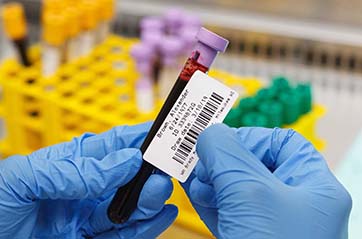 A blood sample in a vial labeled with a patient's name.