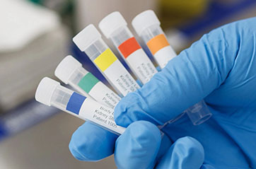 Assorted vials with color-coded labels for lab work.