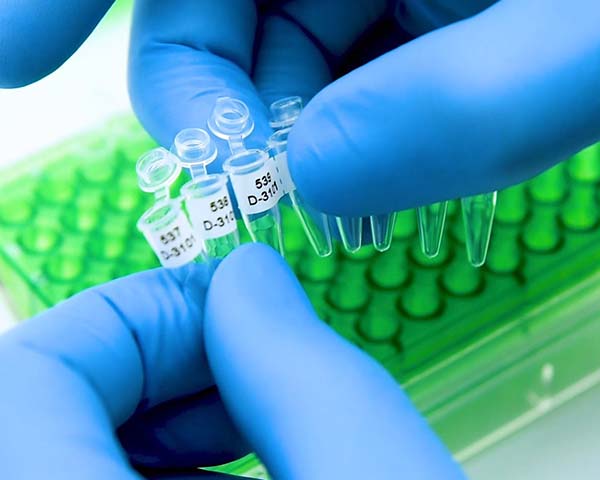 Pequeños frascos que contienen muestras, con etiquetas de identificación cuidadosamente aplicadas para un seguimiento y registro precisos.