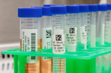 Lab specimen tubes labeled with qr codes and patient information.