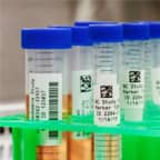 Varios tubos de ensayo con etiquetas preparándose para el almacenamiento criogénico.