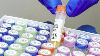 Muestras de laboratorio con etiquetas Brady Freezerbond preparándose para almacenamiento en frío.