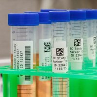 Varias muestras están etiquetadas con códigos QR.