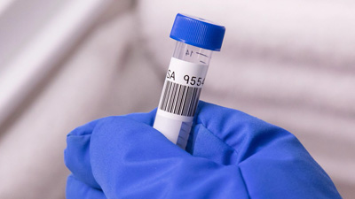 Una muestra etiquetada con un código de barras 2D.