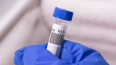 Un técnico de laboratorio sostiene un tubo de ensayo con una etiqueta de poliéster criogénico Brady aplicada en él. La etiqueta tiene texto y un código de barras impresos.